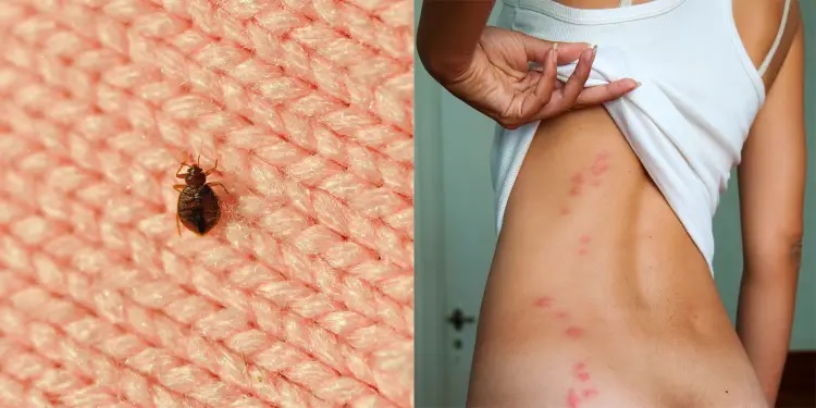 Insects Bite