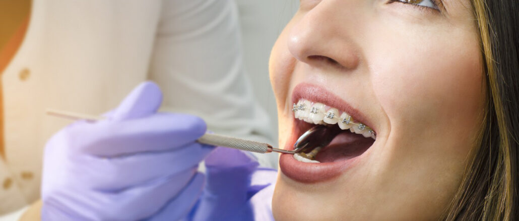 dental in upper roseville newark nj